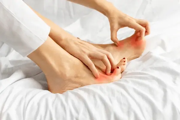 athletes foot treatment near you