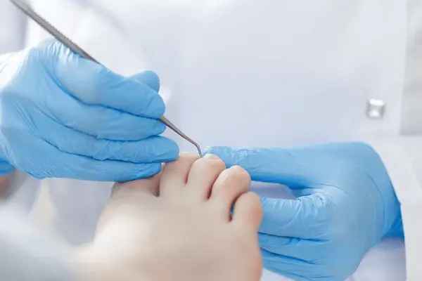 brittle nail treatment in austral, nsw