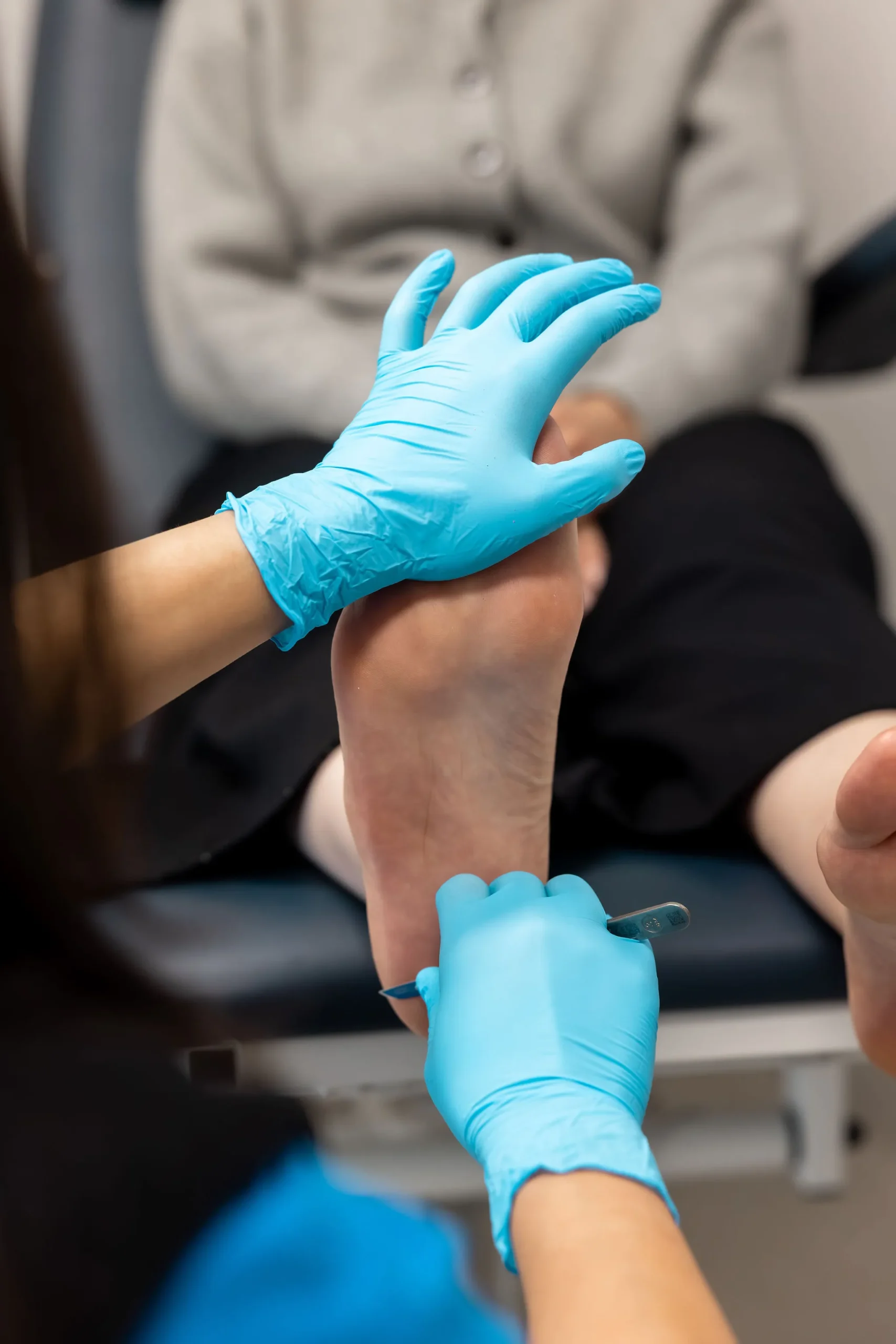 calluses corns blisters care near you