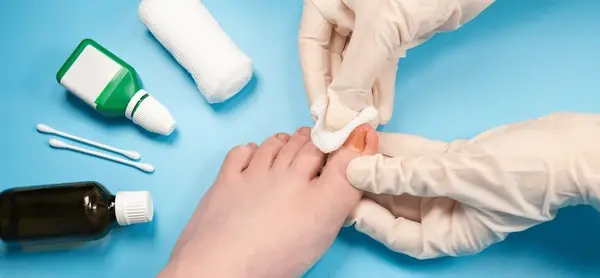 chronic wound support near you