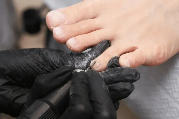 crumbly nail treatment in austral, nsw
