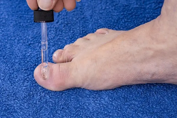 fungal toenail treatment near you