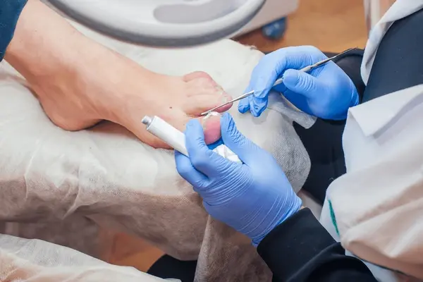 nail thinning near you