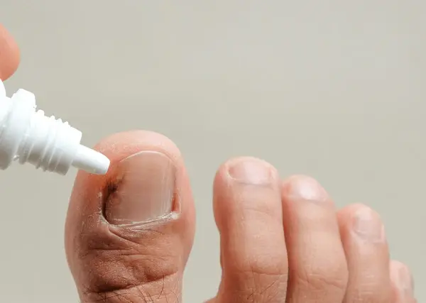 ongoing fungal nail care near you