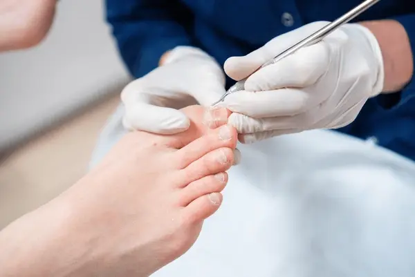partial nail avulsion in austral, nsw