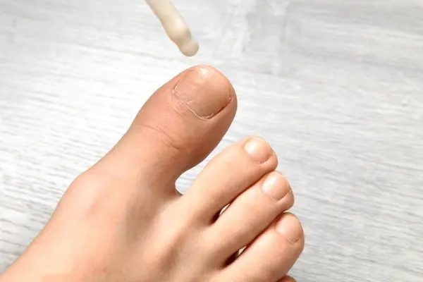 targeted topical treatments near you