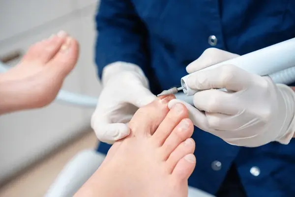 thickened nail treatment in austral, nsw