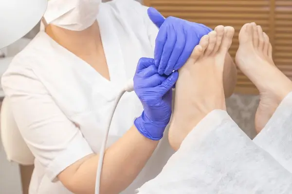 wart debridement near you